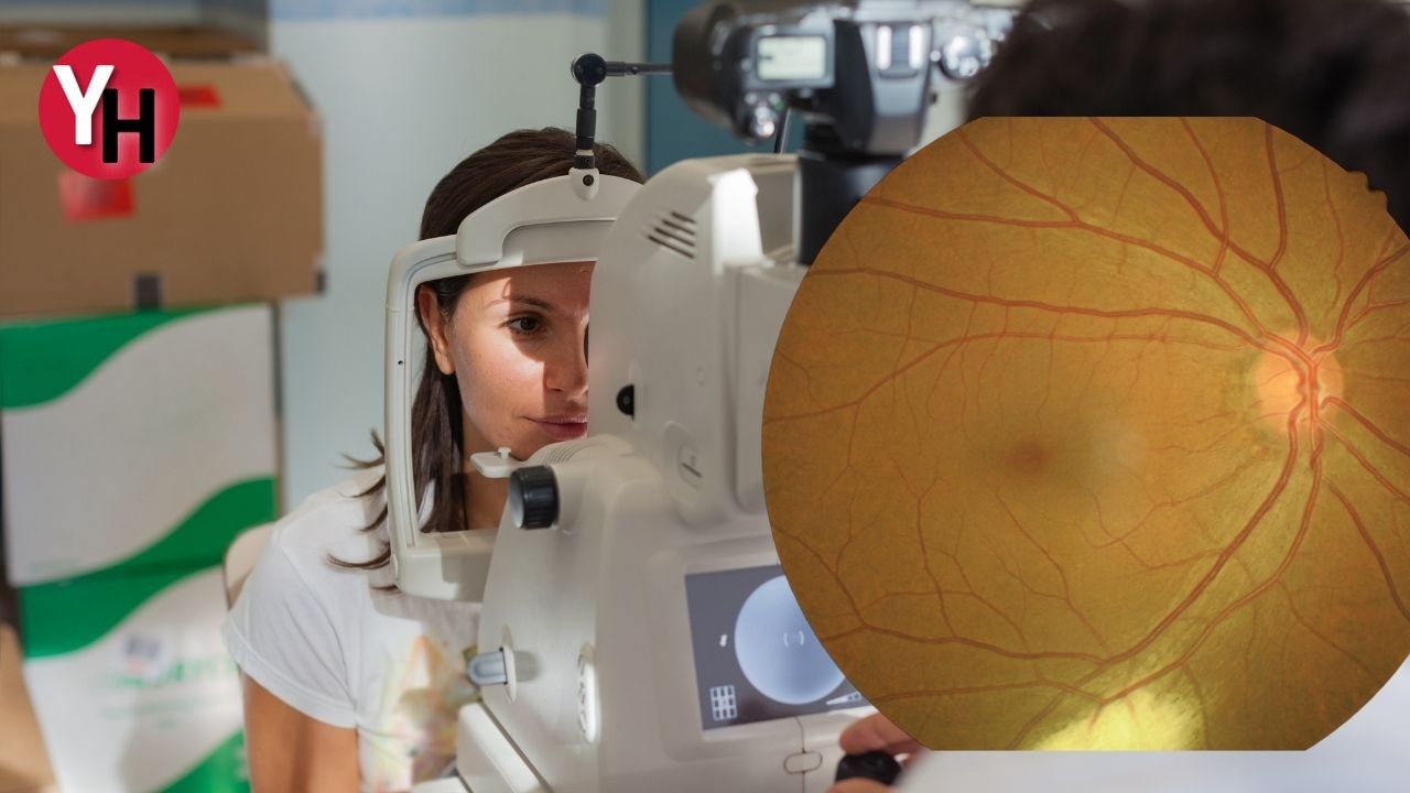 Retina Yırtığı Nedir? Retina Yırtığı Belirtileri Nelerdir?