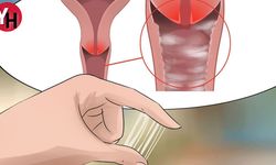 Vajinada Akıntı ve Chlamydia Enfeksiyonu