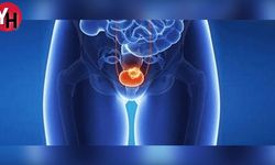 Prostat Kanserinin Hormonal Tedavisi Nedir?