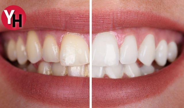 Ağız ve Diş Sağlığınızdaki En Yaygın 10 Yanlışa Dikkat!