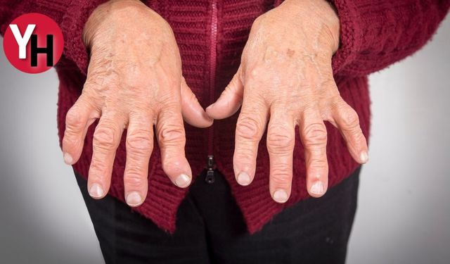 Artrit nedir? Belirtileri, Nedenleri ve Tedavisi