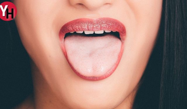 Dilin Rengi Beyazsa Ne Anlama Gelir? Beyaz Dil Neden Olur?