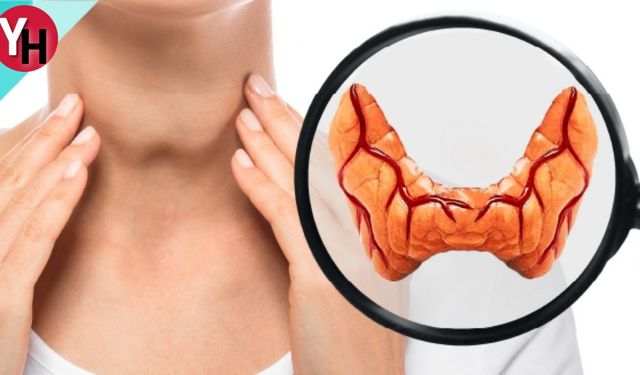 Hipotiroidi Nedir ve Nasıl Tedavi Edilir? Hipotiroidi Belirtileri Nelerdir ve Nasıl Anlaşılır?