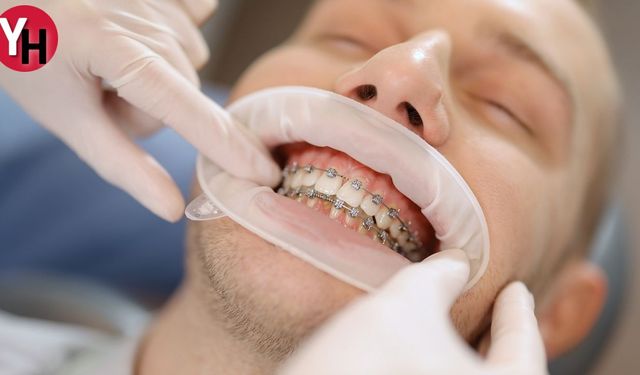 Ortodonti Tedavi Çeşitleri ve Uygulama Yöntemleri Nelerdir?