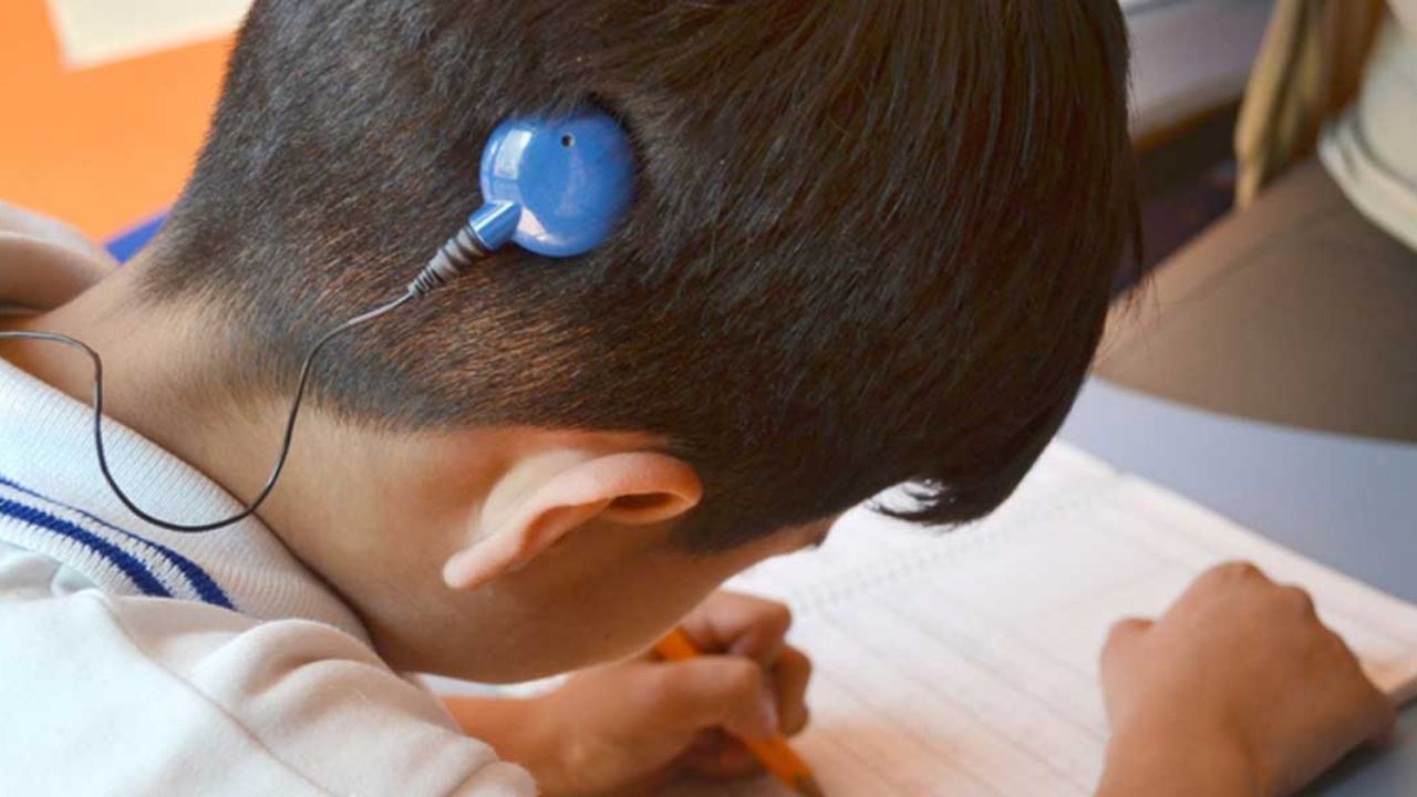İşitme Kaybının Yeniden Ses Bulma Yolculuğu Biyonik Kulak Ameliyatı (1)