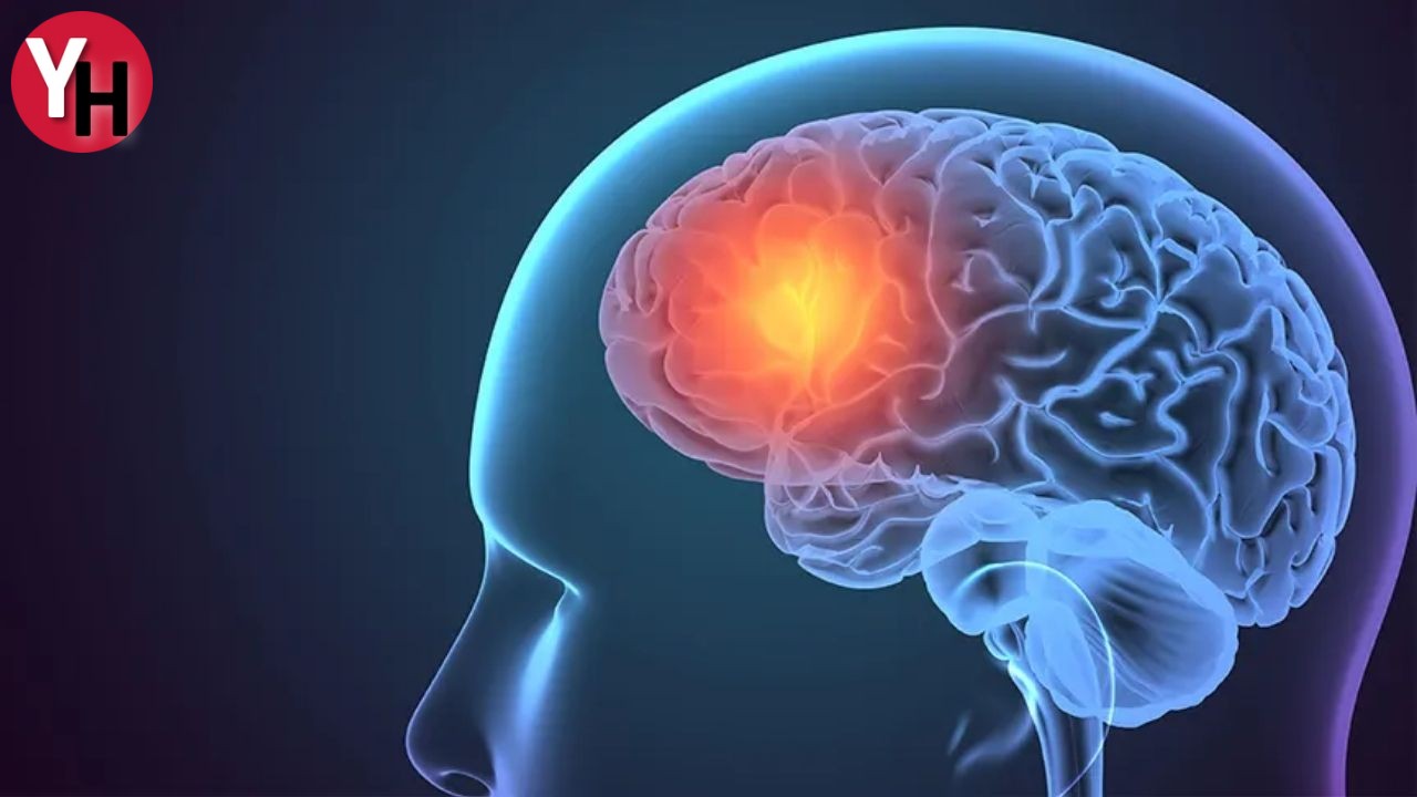 Parkinson Tedavisinde En Etkili Yöntem Beyin Pili (1)